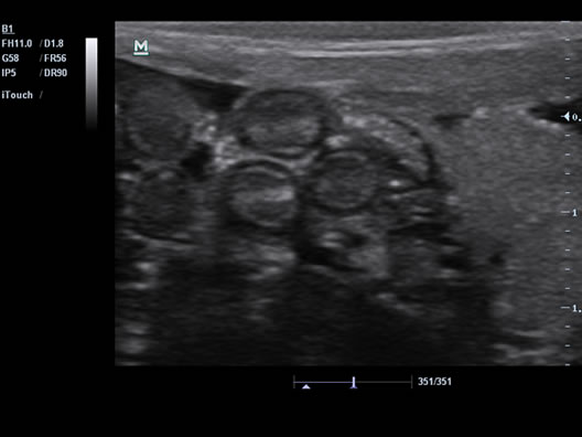 Turtle-Ovary & Spawn